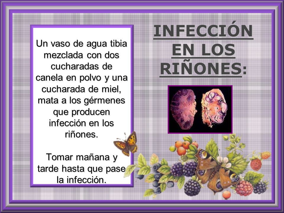 Los preparados los dolores que calman en la espalda de la inyección